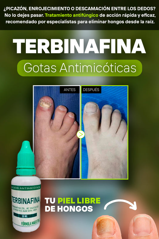 TERBINAFINA GOTAS ANTIMICOTICAS